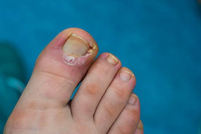 Exploring Innovative Treatments in Podiatry