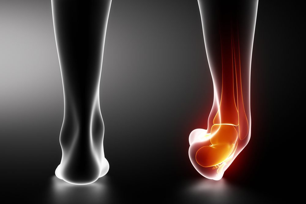 Recognizing the Symptoms of Ankle Sprains