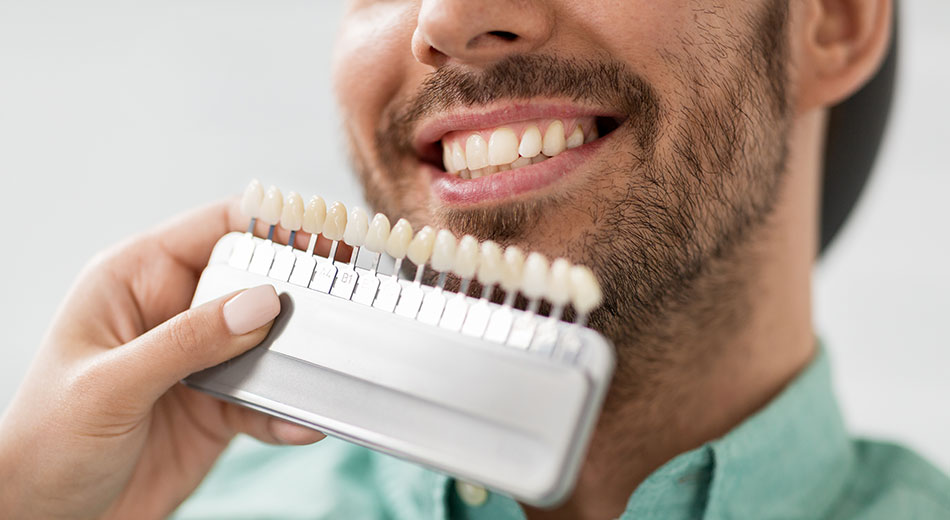 How to Choose the Right Color for Your Veneers