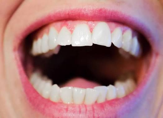 The Impact of Gum Disease on Your Smile